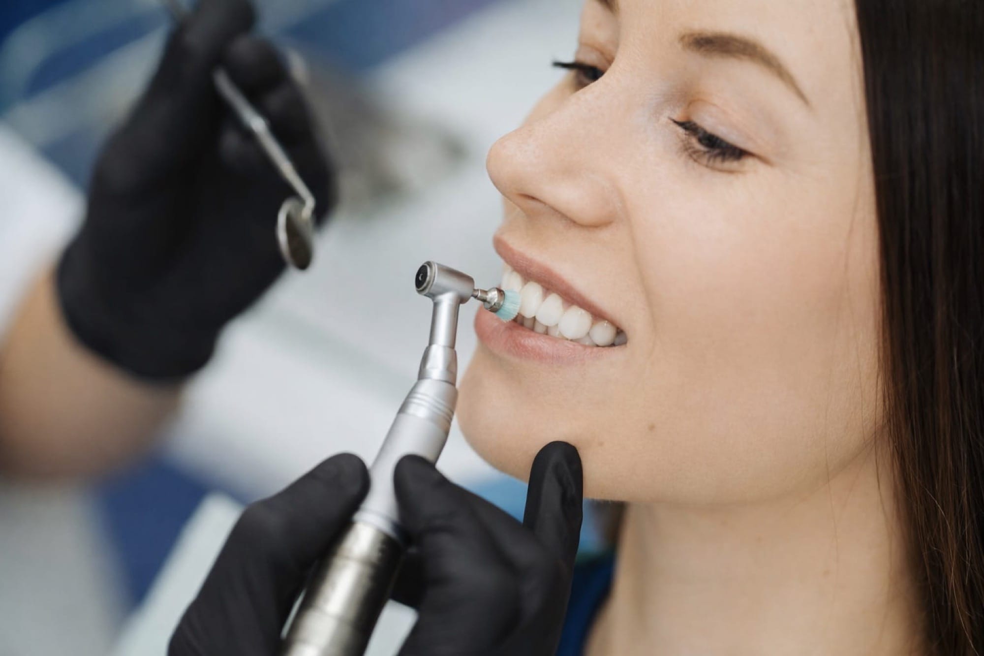 Professionelle Zahnreinigung: Eine Frau erhält eine Behandlung mit einem Instrument zur Reinigung oder Politur der Zähne.